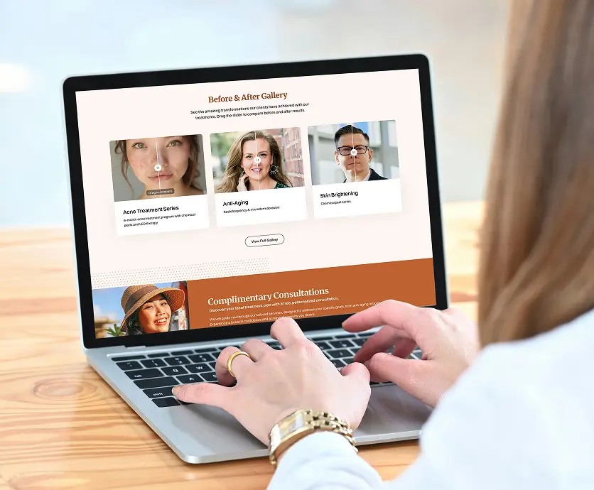 Before & After Gallery